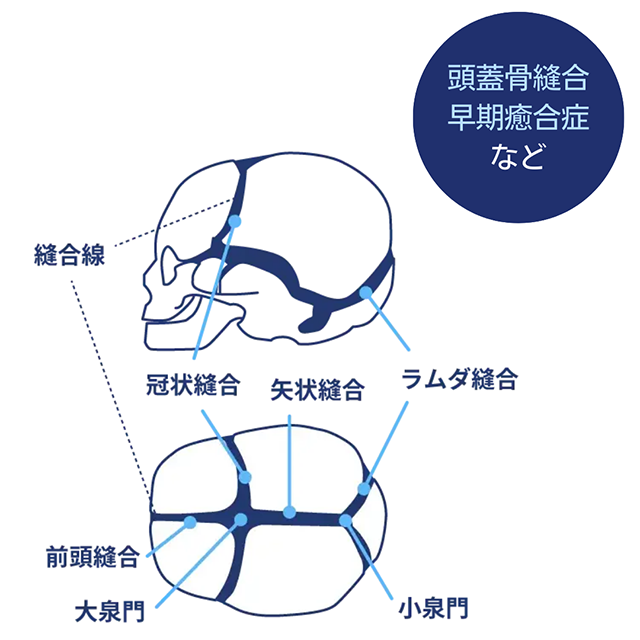 頭蓋骨縫合